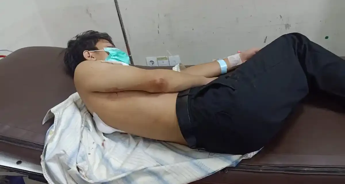 Tawuran Remaja Di Makasar Jaktim, 1 Orang Luka Di Bacok