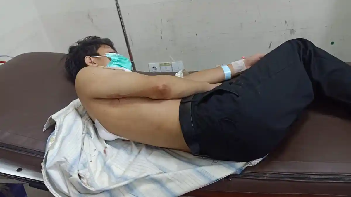 Tawuran Remaja Di Makasar Jaktim, 1 Orang Luka Di Bacok